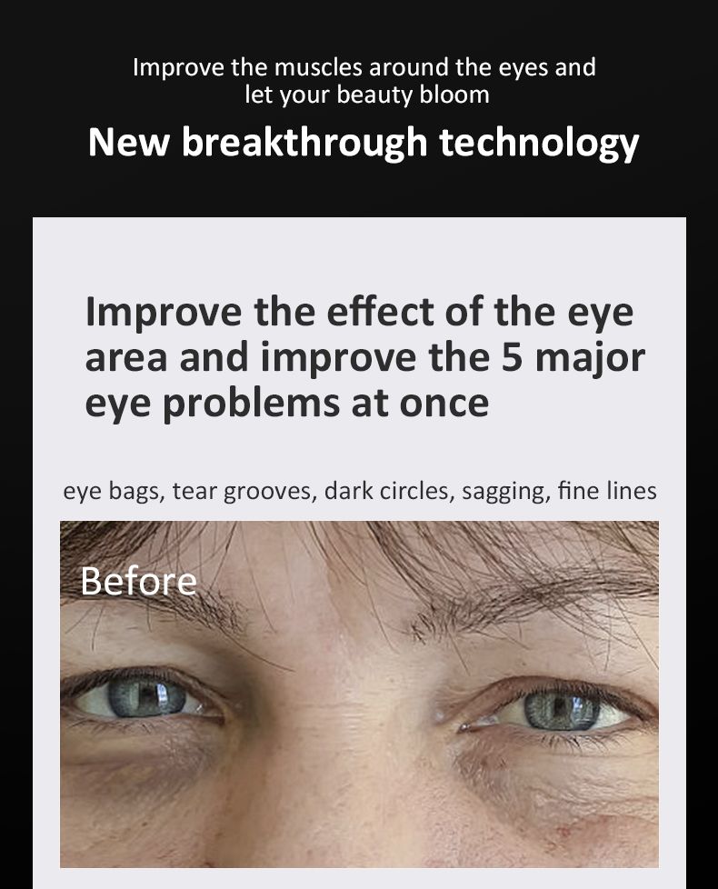 3D EMS Microcurrent Eye Massager – Advanced Eye Lift & Anti-Aging Therapy