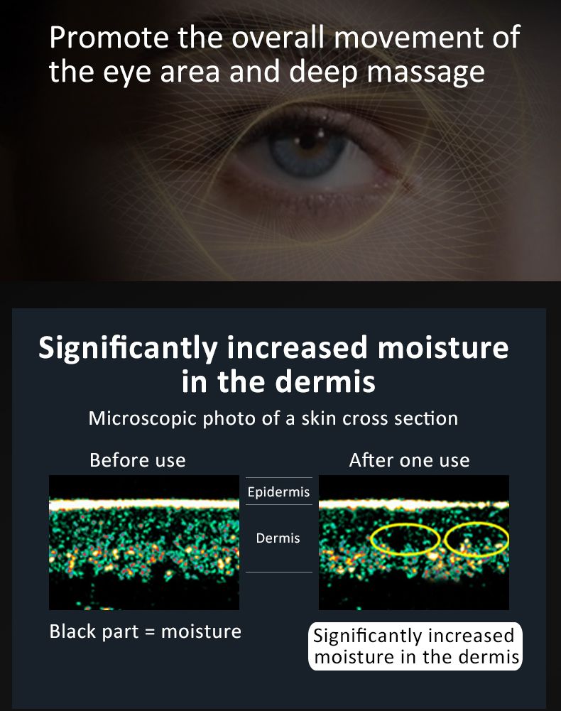 3D EMS Microcurrent Eye Massager – Advanced Eye Lift & Anti - Aging Therapy - FOREVER - 25 - LIFESTYLES