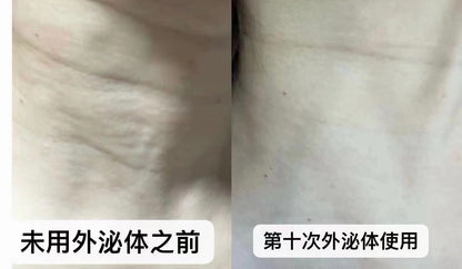 REGENERATIVE MEDICINE CRYOPRESERVATION OF LIVING CELLS - FOREVER - 25 - LIFESTYLES