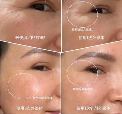 REGENERATIVE MEDICINE CRYOPRESERVATION OF LIVING CELLS - FOREVER - 25 - LIFESTYLES